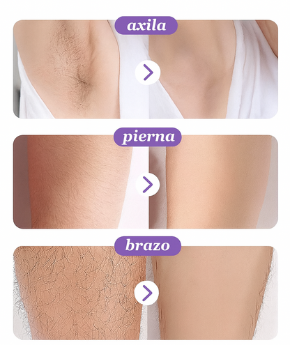 Depiladora de nanocristales - GlowSkin